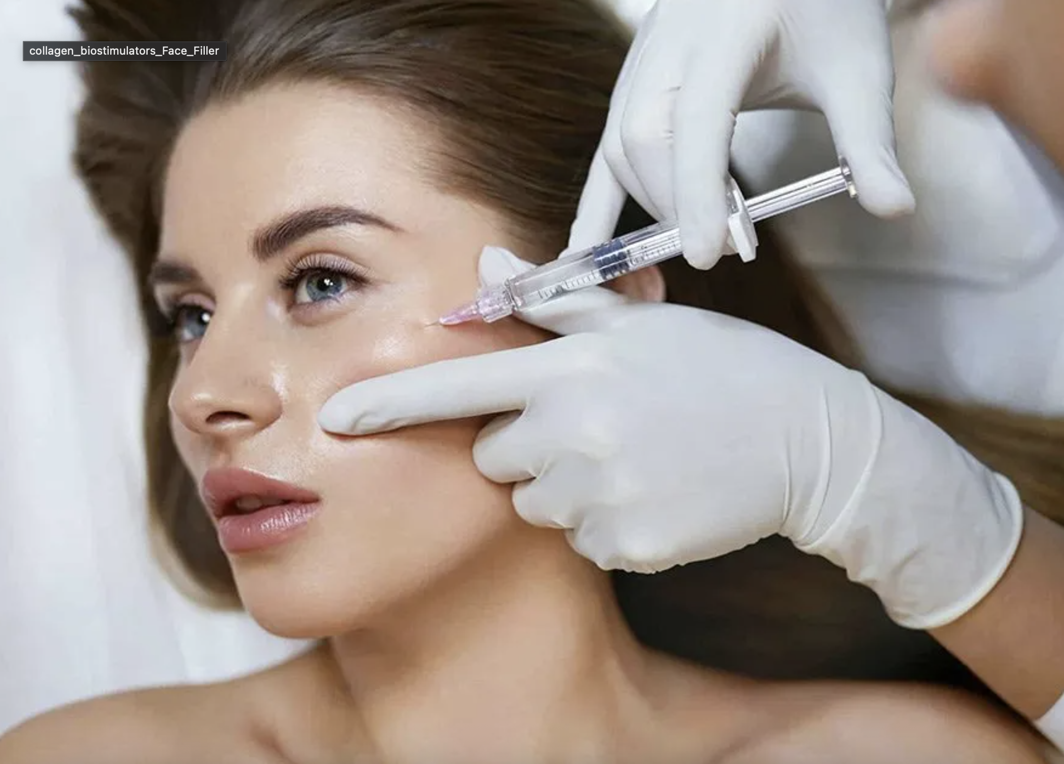 Collagen Biostimulators