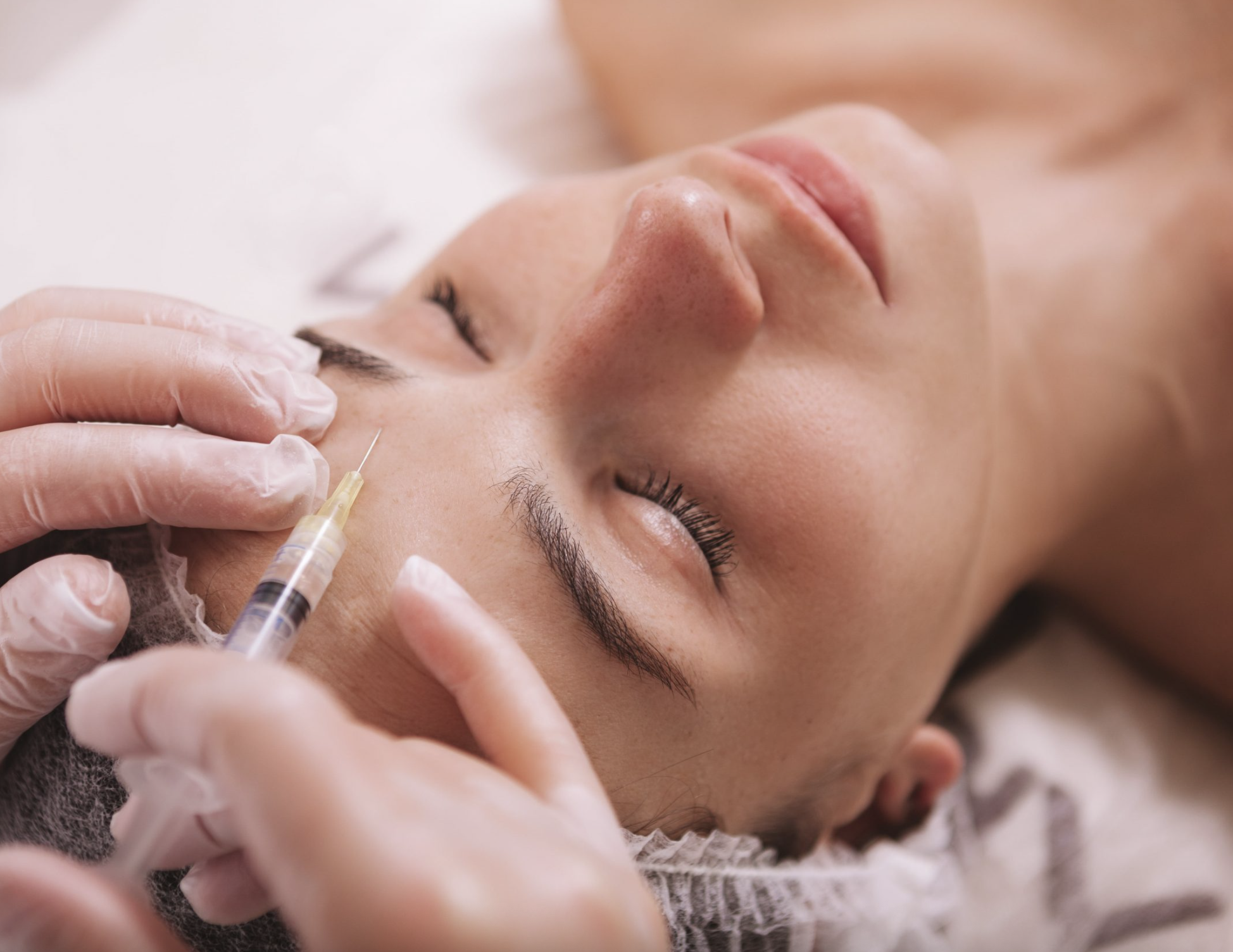 Hyaluronic Acid Fillers